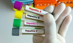 hepatitte-asilama-kronik-enfeksiyonlari-onlemede-95-etkili-SbmEMB6v.jpg