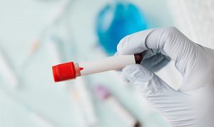 sepsis-vucudun-sessiz-firtinasi-KuEzYbnu.jpg