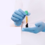 prp tedavisi diz (3)